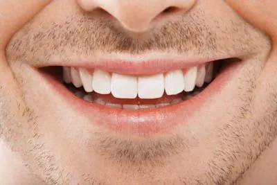 closeup of man's freshly whitened smile